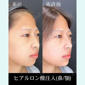 HAAB×DREAM BEAUTY CLINIC 大阪梅田院 柏木 太雅医師の症例