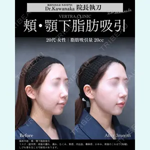 ヴェルトラクリニック 大阪院 河中聡之医師の症例