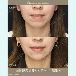 シンデレラ＆ダヴィンチクリニック 佐藤 博文医師の症例
