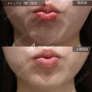 症例