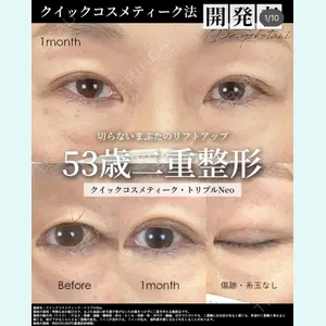 湘南美容クリニック 大阪梅田院 横谷 仁彦医師の症例