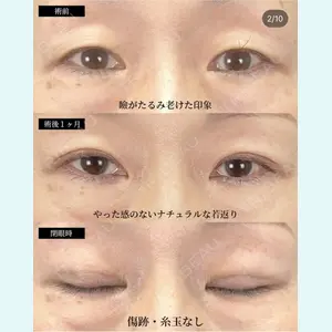 湘南美容クリニック 大阪梅田院 横谷 仁彦医師の症例