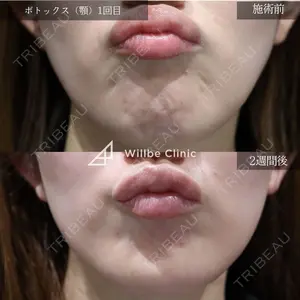 症例