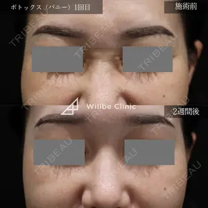 症例