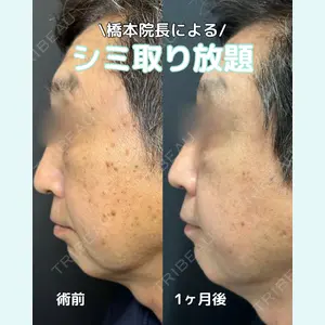 症例
