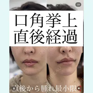 症例