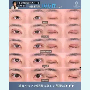 症例