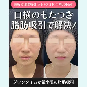 湘南美容クリニック 川崎院 伊藤 賀敏医師の症例