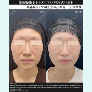 湘南美容クリニック 川崎院 伊藤 賀敏医師の症例