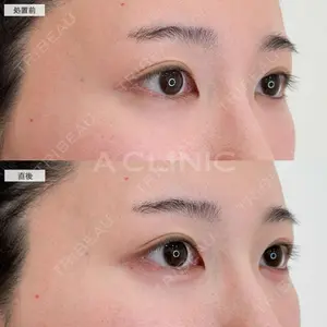A CLINIC（エークリニック） 銀座院 中原 良介医師の症例