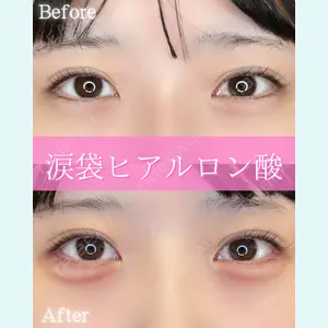 ルラ美容クリニック 大阪本院 平田 一記医師の症例