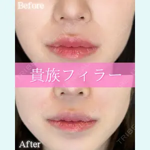 ルラ美容クリニック 大阪本院 平田 一記医師の症例