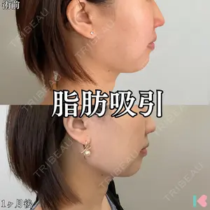 症例