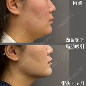 吉井クリニック 吉井 健吾医師の症例