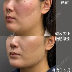 吉井クリニック 吉井 健吾医師の症例