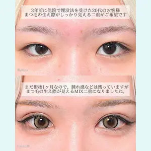 症例