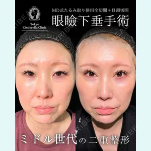 症例