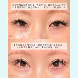 症例