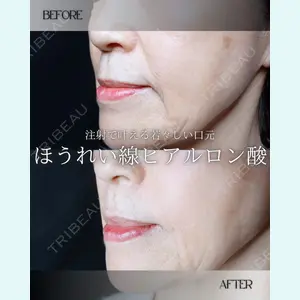 小倉美容外科/美容皮膚科 ビラビューティークリニック 大村 亞蘭医師の症例