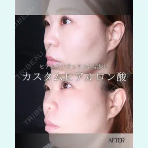 小倉美容外科/美容皮膚科 ビラビューティークリニック 大村 亞蘭医師の症例