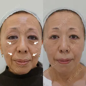 ATELIERMedicalClinicの症例