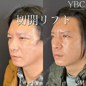 症例