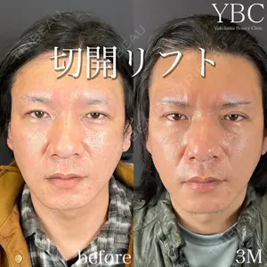 症例