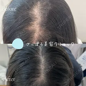 さっぽろ美容クリニックの症例