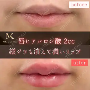 MKクリニック 銀座院の症例