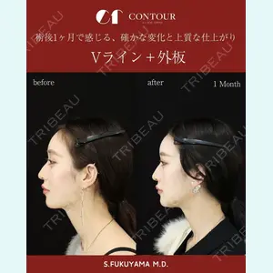 コントアクリニック 東京 福山 漱辰医師の症例