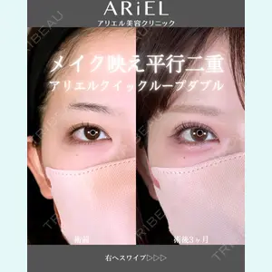 アリエル美容クリニック 郡山院 安齋 誠基医師の症例