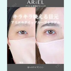 アリエル美容クリニック 郡山院 安齋 誠基医師の症例