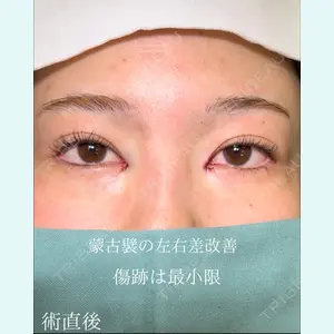 症例