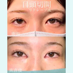 症例
