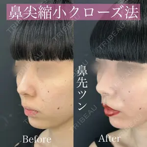ルラ美容クリニック 渋谷本院 昼間 路子医師の症例