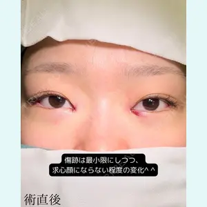 症例