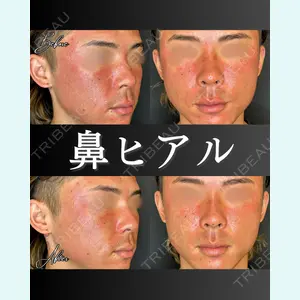 ルラ美容クリニック 大宮院 右京 大季医師の症例