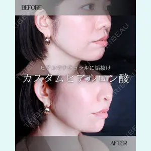 小倉美容外科/美容皮膚科 ビラビューティークリニック 大村 亞蘭医師の症例
