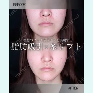 小倉美容外科/美容皮膚科 ビラビューティークリニック 大村 亞蘭医師の症例