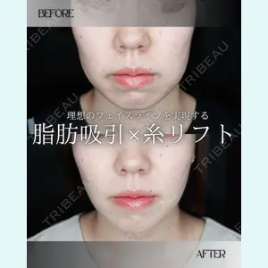 小倉美容外科/美容皮膚科 ビラビューティークリニック 大村 亞蘭医師の症例