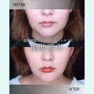 小倉美容外科/美容皮膚科 ビラビューティークリニック 大村 亞蘭医師の症例