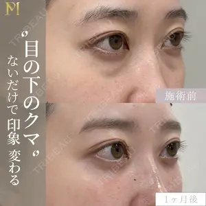 症例