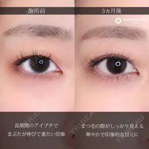 症例