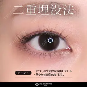 症例