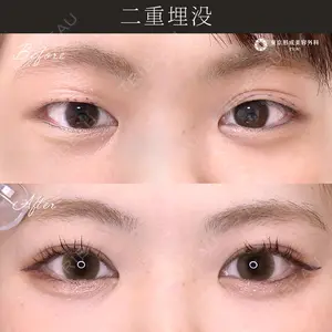 症例