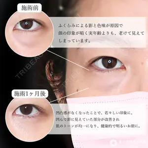 東京形成美容外科 船橋院 山崎 修吾医師の症例