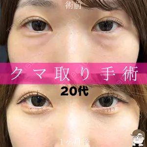 症例