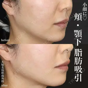 大塚美容形成外科 銀座本院 石井秀典医師の症例