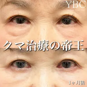 症例