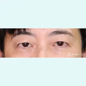 症例